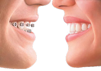 Ortodonti